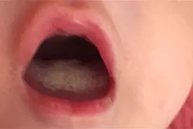 孩子是否健康，看看舌头就知道！这样的舌头才是健康的！视频封面