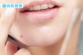 嘴唇上长小水泡，并且有灼痛感，涂什么药膏好？视频封面