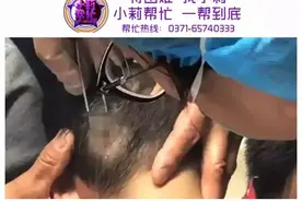 拨开孩子头发，家长魂都吓飞！此病可致死，还会人传人图片