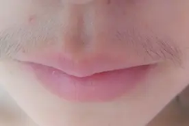 女生唇毛太重太尴尬，可不要傻傻的剃掉，教你这招让唇毛不再长视频封面