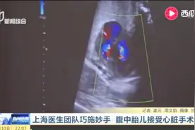 女子怀孕29周 检查发现胎儿心脏发育不良 女子面临艰难抉择视频封面