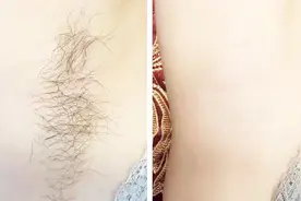 脱毛膏不用买，厨房三样东西就能做到，成本低效果好，用过都说好视频封面