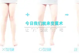 八字腿变11腿的方法！3D演示膝关节到股骨视频封面