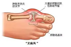 「健康」全了！各年龄段血压、血糖、血脂、尿酸对照表，快告诉家人图片