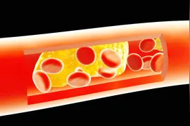 老年人常常被血管堵塞困扰，一个简单的动作，轻松帮你疏通血管！视频封面