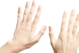 手上有这几个症状，可能是血糖偏高的表现，希望你一个都没有！视频封面