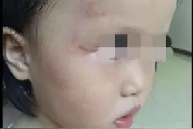 广州一幼儿园被曝虐童 涉事老师已被警方带走调查图片