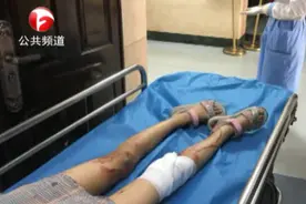 危险护栏“咬伤”8岁女孩 右腿被划一二十公分口子 鲜血淋漓视频封面