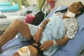 “熊出没”放羊大爷疑似遭熊袭击 面颊腮部伤口几乎穿透图片