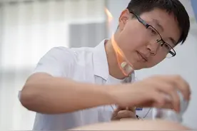 拔罐配合艾筒灸，肺经寒气往外走图片