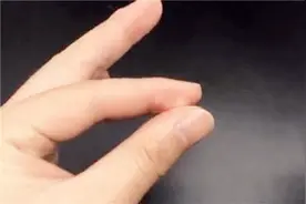 502滴在手上别怕，只需家里一个小物件，马上就能去除！视频封面