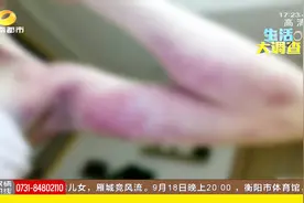 足不出户在家拍痧利于健康？医生告诉你正确的做法视频封面