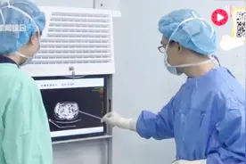 “移植肾”遇上“肾结石”还有救吗？听听专家怎么说！视频封面