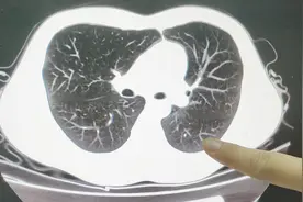 一个胸部CT的详细解剖讲解，包括肺叶、胸廓和纵隔全程干货视频封面