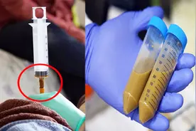 靠着捐屎发家致富，一年能赚90000，网友：组团捐屎去！视频封面