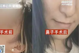 女子花8万元，整容成迪丽热巴，结果整出个“鹰钩鼻”……视频封面
