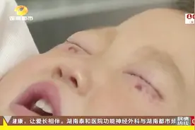 2岁女童被邻居小哥哥泼一脸石灰 家长又用洗脸布清洗致二次伤害！视频封面