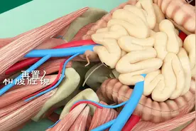 3D演示：阑尾炎手术过程，看完恍然大悟视频封面