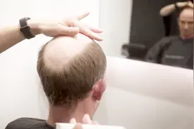 中年男性头顶掉的没多少根了，直接推光粘个假发，帅到大哥都笑了视频封面