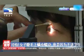 年轻女孩睫毛上竟有寄生虫蠕动，简直太可怕了视频封面
