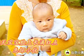 宝宝出生2个月脸上长满红疹，小伙急忙去就诊，原来是这引起的视频封面