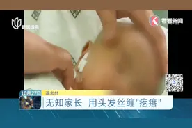 女婴脸上长肉疙瘩，无知家长竟用头发丝缠绕视频封面