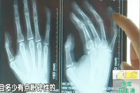 猫咪归来咬断主人手指，“嘎嘣”一声像咬脆骨，养主：万万没想到视频封面