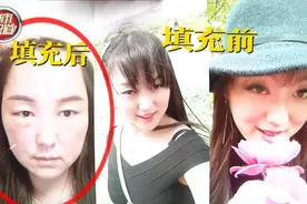 女子：我花三万整成了“猪头”？丈夫：本来貌美如花，现在变“老妖怪”图片