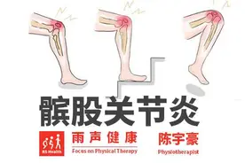 膝盖痛：当心髌骨软化/髌股关节炎？图片
