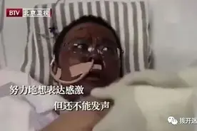 黑脸医生不是因为色素沉积，而是严重的肾毒性图片