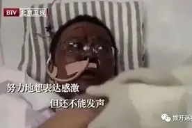 黑脸医生不是因为色素沉积，而是严重的肾毒性图片
