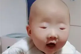 “小眼宝宝”火了，眼睛小得像绿豆，网友捧腹：李荣浩小时候？图片