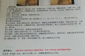 怀孕千万别吃鸭肉图片
