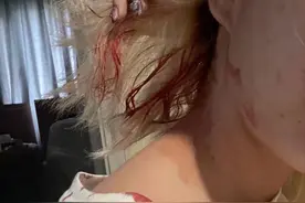 美女网红惨遭男友家暴，头部裂伤严重都是血，被邻居救后绝望发文图片