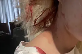 美女网红惨遭男友家暴，头部裂伤严重都是血，被邻居救后绝望发文图片