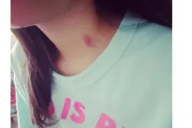 13岁女儿脖子出现"草莓印"，妈妈没骂没打，一招挽救女儿恋爱观图片