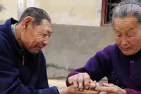猴娃是什么病？脑容量仅671cc(不如婴儿大/确诊小脑症)图片
