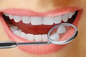 洗牙真的不会伤害牙齿吗？为什么洗完总感觉敏感？看完算搞懂了图片