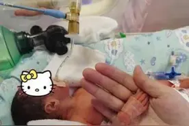 胎龄6个多月的早产儿闯过几道生死关，平安回家了！图片