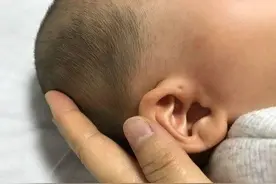娃耳朵上的“小孔”是聪明洞？医生通常不会明说，妈妈要心知肚明图片