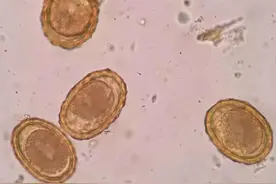 几十年前几乎人人肚子里都有蛔虫，为什么现在的人不打蛔虫了？图片