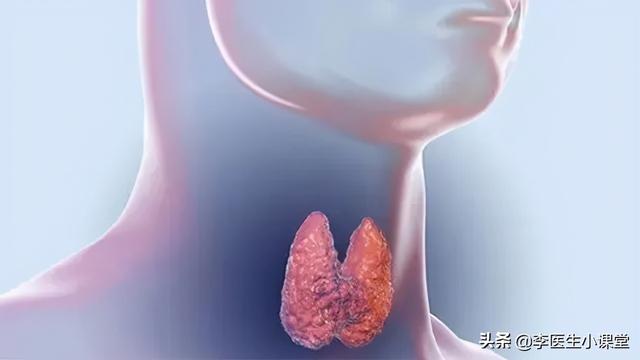 甲状腺结节禁忌 2026年甲状腺结节禁忌哪些东西不能吃