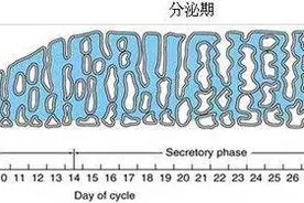 哪来的那么多“内膜增厚”图片