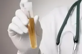 我的尿液有酮体，好怕怕图片
