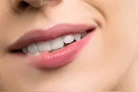 你知道牙贴面不仅美白，还保护牙齿吗？图片