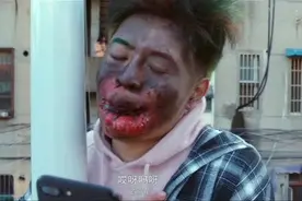 小伙子直播为了让粉丝刷礼物，爬到电线杆上鞭炮炸嘴巴图片