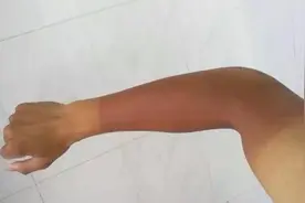 为什么有些人一晒就变黑，而有的人怎么晒都很白？怎么做到后者图片