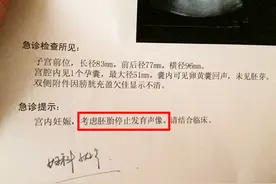 怀孕10周看不到胎心，是胎儿发育不好吗？孕早期做好4点远离胎停图片
