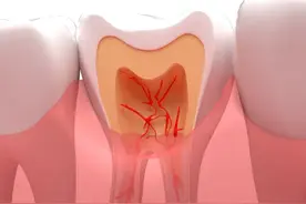 牙痛总是觉得晚上比早上痛？图片