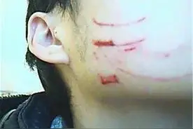 6岁儿子被同学抓到破相，妈妈的高情商做法，让老师心悦诚服图片